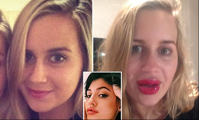 Australian Woman Buys A Lip Enhancer Online And The Results Are Not What She Expected Daily Mail Online